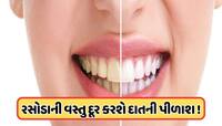 પીળા દાંત થઈ જશે એકદમ મોતી જેવા સફેદ, આ ઘરેલું ઉપાયથી દાંતમાં આવી જશે ચમક !  