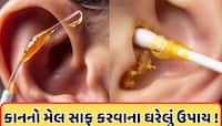 કાનની અંદર જામેલી ગંદકી ખેંચીને બહાર કાઢશે આ રામબાણ ઉપાય! જાણો ઘરેલું ઉપાય