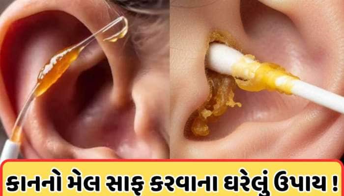 કાનની અંદર જામેલી ગંદકી ખેંચીને બહાર કાઢશે આ રામબાણ ઉપાય! જાણો ઘરેલું ઉપાય