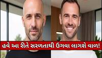 હવે ટાલિયાપણાથી મળશે છૂટકારો! વૈજ્ઞાનિકોએ વાળને ફરીથી ઉગાડવાની કરી સરળ શોધ