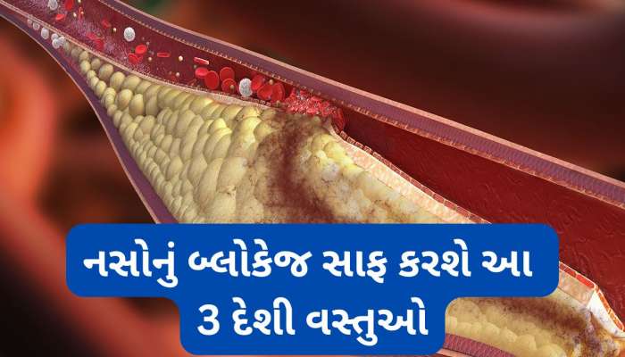 Bad Cholesterol: શરીરમાં કોલેસ્ટ્રોલ વધી ગયું હોય તો આ 3 વસ્તુ અજમાવો, નસોમાં જામેલું બ્લોકેજ ઝડપથી સાફ થશે