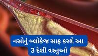 કોલેસ્ટ્રોલ વધી ગયું હોય તો આ 3 વસ્તુ અજમાવો, નસોમાં જામેલું બ્લોકેજ ઝડપથી સાફ થશે
