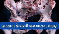 હાડકાનું કેન્સર થાય ત્યારે જોવા મળે છે આ લક્ષણો, 90 ટકા લોકો સામાન્ય સમજી ઈગ્નોર કરે