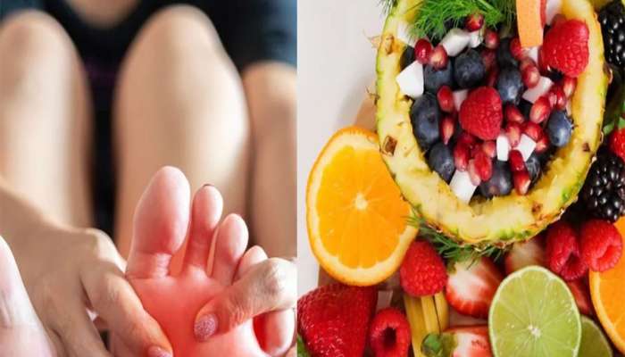 Uric Acid: ઝડપથી યુરિક એસિડ ઘટાડી શકે છે આ 3 ફળ, ગાઉટના દુખાવામાં પણ થશે રાહત