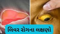 આ 6 લક્ષણ જણાવશે કે તમારૂ લિવર થઈ ગયું છે ખરાબ, નજરઅંદાજ કરશો તો ભારે પડશે