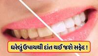 શું તમારા દાંત થઈ ગયા છે પીળા ? આ 2 વસ્તુઓ ઘસો, પીળી ગંદકી સાથે દુર્ગંધ પણ થશે દૂર! 