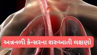 Cancer: અન્નનળીમાં કેન્સર વધતું હોય ત્યારે દેખાય આ લક્ષણો, એસિડીટી સમજી ઈગ્નોર ન કરો