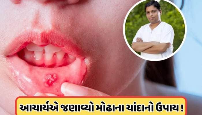 વારંવાર મોઢામાં પડે છે ચાંદા? આચાર્ય બાલકૃષ્ણએ કહ્યું કે આ પાંદડાના પાણીથી કરો કોગળા