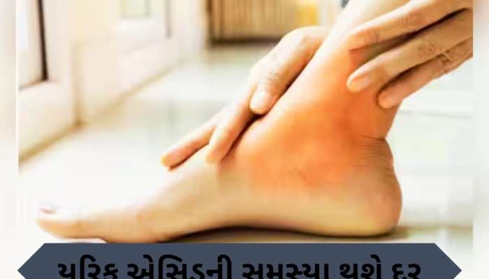  યુરિક એસિડને કારણે પગમાં થઈ રહ્યો છે દુખાવો, અપનાવો આ 5 ઘરેલું નુસ્ખા, જલ્દી મળશે રાહત