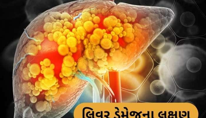 Liver Damage: લિવર ડેમેજનું સૌથી મોટું લક્ષણ, આ સમસ્યા થાય તો ડોક્ટરને જરૂર દેખાડો