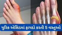 આ 5 વસ્તુઓ ખાવાનું શરુ કરી દો, 100 ની સ્પીડ ઘટશે યુરિક એસિડ, શરીર થશે ડિટોક્સ