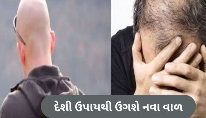 ટાલમાં ઉગી જશે નવા વાળ! બસ અપનાવો આ 3 ઘરેલું ઉપાય, ફટાફટ થશે હેર ગ્રોથ