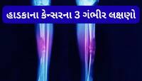 હાડકાનું કેન્સર ગંભીર સ્ટેજમાં પહોંચે ત્યારે દેખાય આ લક્ષણ, અહીંયા થાય તીવ્ર દુખાવો