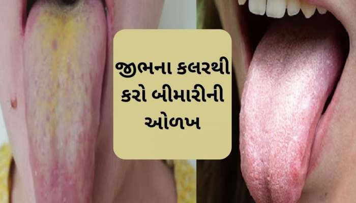  જીભ પર લાલ, પીળા, વાદળી રંગના નિશાન દેખાય તો સાવધાન રહો, આ રોગોનું લક્ષણ હોઈ શકે છે