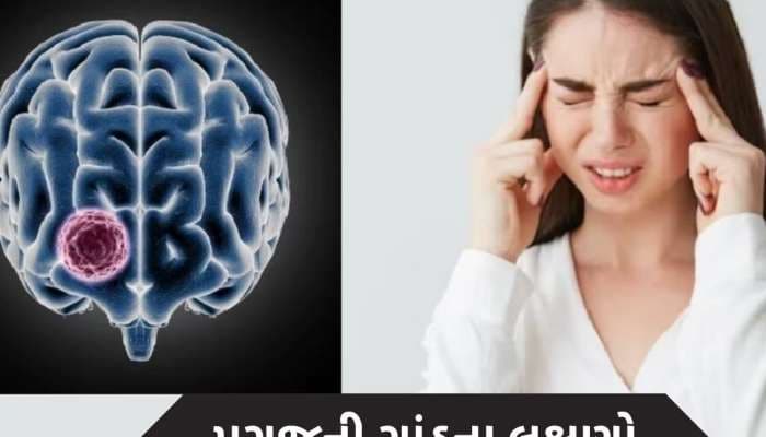 બ્રેન ટ્યુમર થાય તો જોવા મળે છે આ 5 લક્ષણ, સામાન્ય સમજી નજરઅંદાજ કરશો તો પડશે ભારે