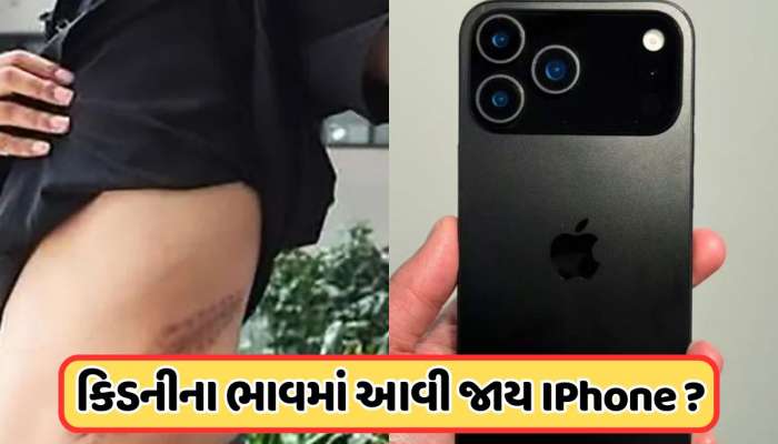 શું કોઈ વ્યક્તિ કિડની વેચીને આઈફોન ખરીદી શકે છે? કિડનીની કિંમત કેટલી છે?