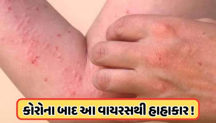 દુનિયાભરમાં ફરી વાગી ખતરાની ઘંટી! કોરોના પછી હવે આ વાયરસ મચાવી રહ્યો છે તબાહી, જાણો