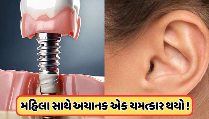 સુરતમાં થયો ચમત્કાર ! દાંતની સર્જરીએ સાજા કરી દીધા મહિલાના કાન, 10 વર્ષથી મહિલાને હતી તકલીફ