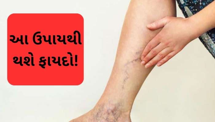   બંધ અને જામ થયેલી નસો ખોલવા માટે સ્વામી રામદેવના આ ઉપાયો અપનાવો,  દુખાવામાં રાહત મળશે