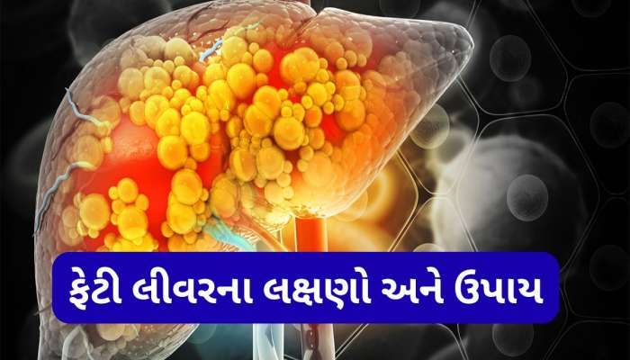 લીવરને સડતા બચાવવું હોય તો આ રીતે ખાવી હળદર, આ ઉપાય ફેટી લીવરમાં કરશે ફાયદો