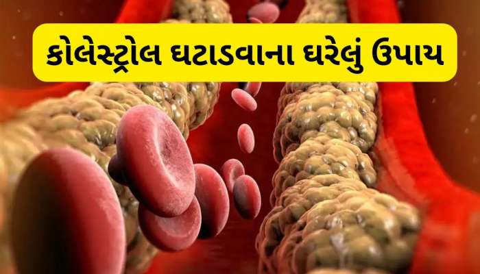 આ પાણી ખાલી પેટ પીઓ, તમારી નસોમાં જામેલા બેડ કોલેસ્ટ્રોલને કરશે દૂર!