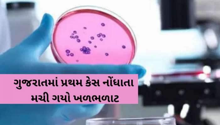 ભાગ્યે જ જોવા મળતો રેર ઓફ ધ રેર રોગ ગુજરાતમાં નોંધાયો! જાણો આ બિમારીનો છે કોઈ ઈલાજ