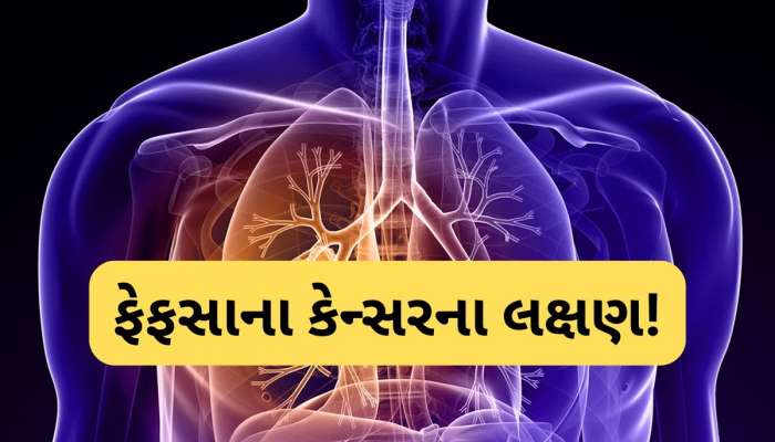  સ્મોક નથી કરતાં છતાં થઈ શકે છે ફેફસાનું કેન્સર! આ શરૂઆતી લક્ષણોને સમય રહેતા ઓળખો