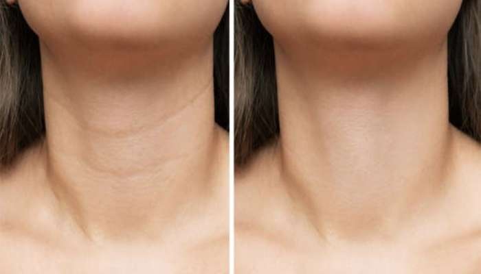 Anti Aging Face Pack: ચહેરા અને ગરદનની કરચલીઓ દુર કરે એવા કેળાના ફેસ પેક બનાવવાની રીત, ક્રીમ કરતાં બેસ્ટ રીઝલ્ટ મળશે