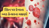 સ્કિન પર આ રીતે દેખાય છે બ્લડ કેન્સરના શરુઆતી લક્ષણો, સમયસર ઈલાજથી કેન્સરમાં બચી શકે