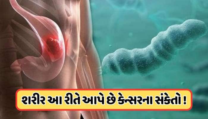 શરીર શરૂઆતમાં જ આપી દે છે પેટના કેન્સરના 5 સંકેતો, ચોથું લક્ષણ શંકાને વધારશે !
