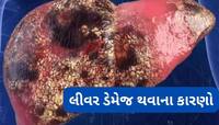Fatty Liver: આ 4 આદતોના કારણે જુવાનીમાં જ સડી જાય છે લીવર, તમને તો નથી ને આ આદતો ?
