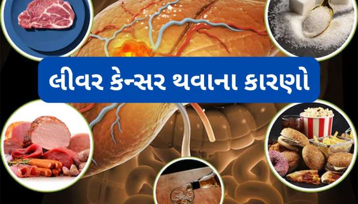 Liver Cancer: લીવર માટે એસિડ સમાન છે આ 5 ફુડ્સ, રોજ ખાવાથી શરીરમાં ડબલ સ્પીડથી વધે કેન્સર સેલ્સ