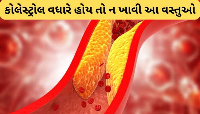 High Cholesterol: કોલેસ્ટ્રોલ હાઈ રહેતું હોય તો ન ખાતા આ Foods, ખાવાથી બ્લોક થઈ જશે ધમનીઓ