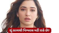 પિમ્પલ્સ પર 'લાળ' લગાવે છે તમન્ના ભાટિયા! નિષ્ણાત પાસેથી જાણો કેટલું છે અસરકારક?