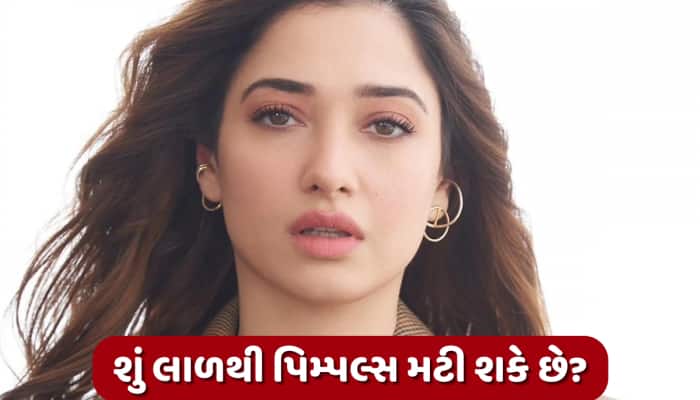 પિમ્પલ્સ પર 'લાળ' લગાવે છે તમન્ના ભાટિયા! નિષ્ણાત પાસેથી જાણો કેટલું છે અસરકારક?
