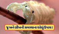 વરસાદની ઋતુમાં વધી ગઈ છે જૂ અને લીખની સમસ્યા ? આ ઘરેલું ઉપાયોથી મેળવો છુટકારો !