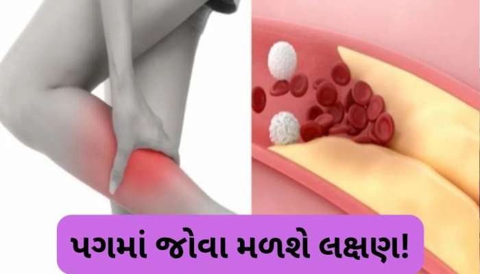 તમારા પગ જ આપશે હાઈકોલેસ્ટ્રોલના સંકેતો, નજરઅંદાજ કરશો તો ભારે પડશે