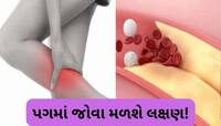 તમારા પગ જ આપશે હાઈકોલેસ્ટ્રોલના સંકેતો, નજરઅંદાજ કરશો તો ભારે પડશે