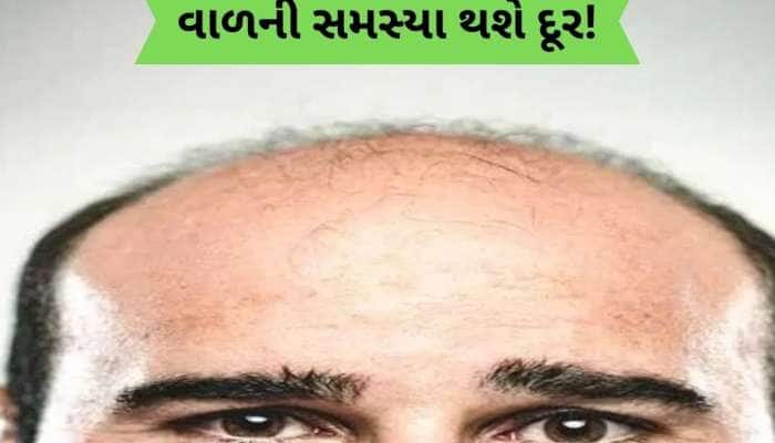 ટાલ પડી ગઈ હશે તો માથામાં ઉગવા લાગશે નવા વાળ, બસ અપનાવો આ દેશી પ્રયોગ