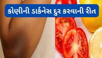 મોંઘી ક્રીમ કે બ્લીચની જરૂર નહીં પડે, આ વસ્તુ લગાડવાથી 3 દિવસમાં સાફ થવા લાગશે કોણી 