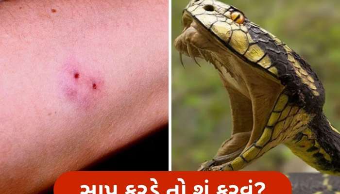  સાપ કરડે તો તાત્કાલિક શું કરવું જોઈએ, આ રીતે તમે શરીરમાં ઝેર ફેલાતું અટકાવી શકો છો