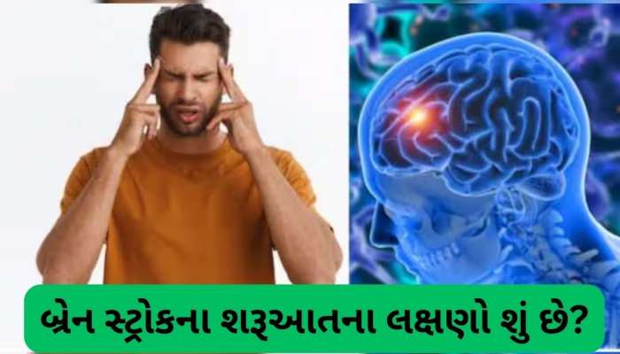  બ્રેન સ્ટ્રોક થાય તો સૌથી પહેલા જોવા મળે છે આ 3 લક્ષણ, ઓળખી લેશો તો બચી જશે જીવ