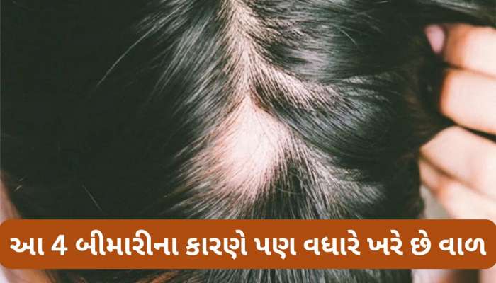 Hair Fall: શેમ્પૂ કે પાણીના કારણે જ નહીં, શરીરમાં આ 4 બીમારી વધતી હોય તો પણ ખરવા લાગે છે વાળ