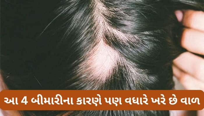 શેમ્પૂ કે પાણીના કારણે જ નહીં, શરીરમાં આ 4 બીમારી વધતી હોય તો પણ ખરવા લાગે છે વાળ