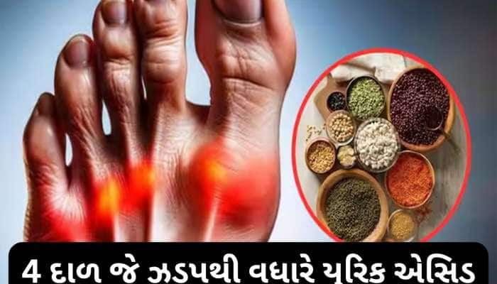 Uric Acid: આ 4 દાળ અને કઠોળ ઝડપથી વધારી શકે છે યુરિક એસિડ, જામ થઈ જશે શરીરના સાંધા