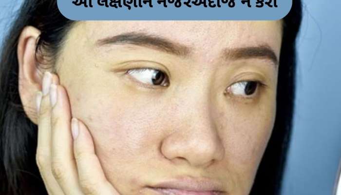 જો ચહેરા પર આ 6 નિશાન દેખાય, તો સમજો કિડની ફેલ થવાની છે, તાત્કાલિક હોસ્પિટલમાં જાઓ