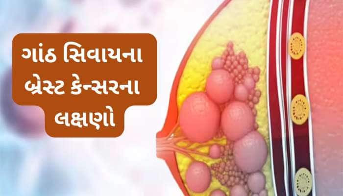 ગાંઠ સિવાયના બ્રેસ્ટ કેન્સરના લક્ષણો, મોટાભાગની મહિલાઓ અજાણતા કરી દે છે ઈગ્નોર