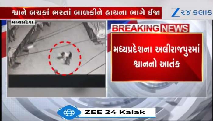 MP: રખડતાં કૂતરાનો આતંક, ઘરની બહાર રમતી બે વર્ષની બાળકી પર કર્યો હુમલો, Video 