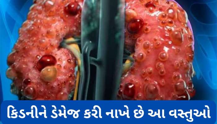 Kidney: આ વસ્તુઓ છે હેલ્ધી પણ કિડની સંબંધિત સમસ્યા હોય તેવા લોકો માટે છે હાનિકારક