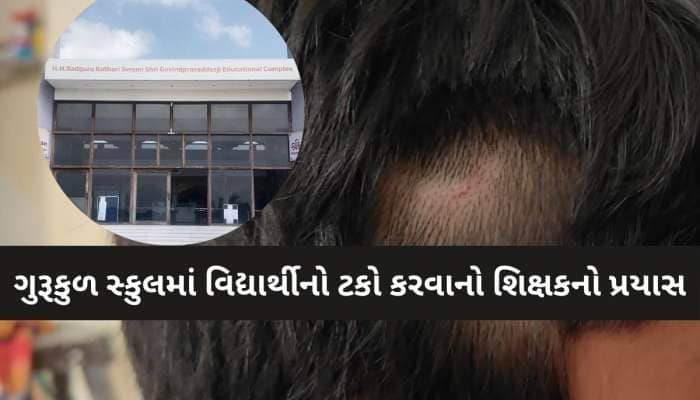 જામનગરમાં સ્વામિનારાયણ ગુરુકુળમાં શિક્ષકની તાનાશાહી: વિદ્યાર્થીના બ્લેડથી વાળ કાપ્યા